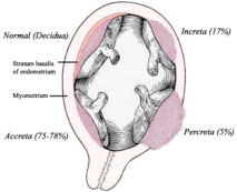 placenta image